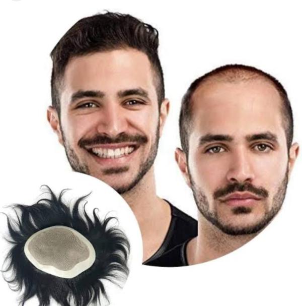 Singh Hair Noida is the best Non-surgica