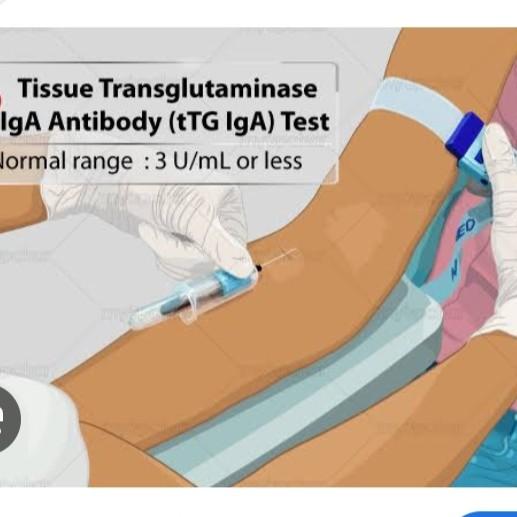 histidine primarily found