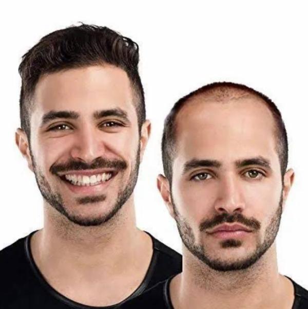 Singh Hair & Skin Cure Noida is the best