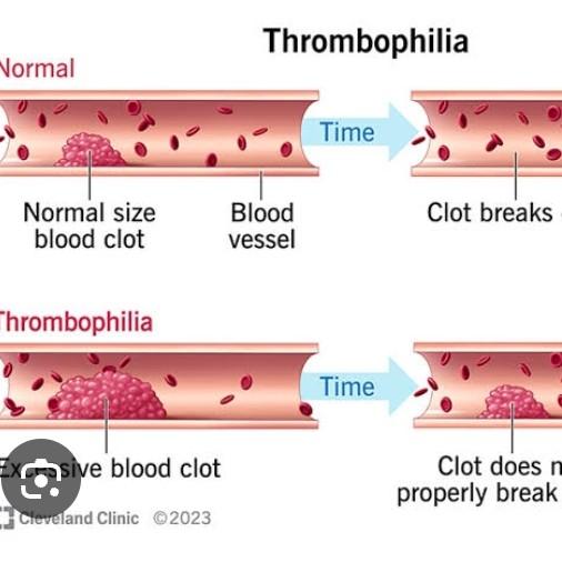 blood clotting disorder screen