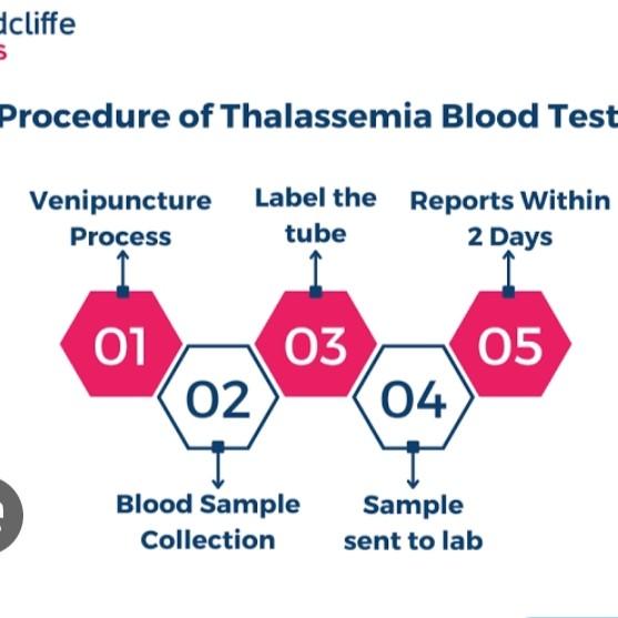 hemoglobin electrophoresis scr