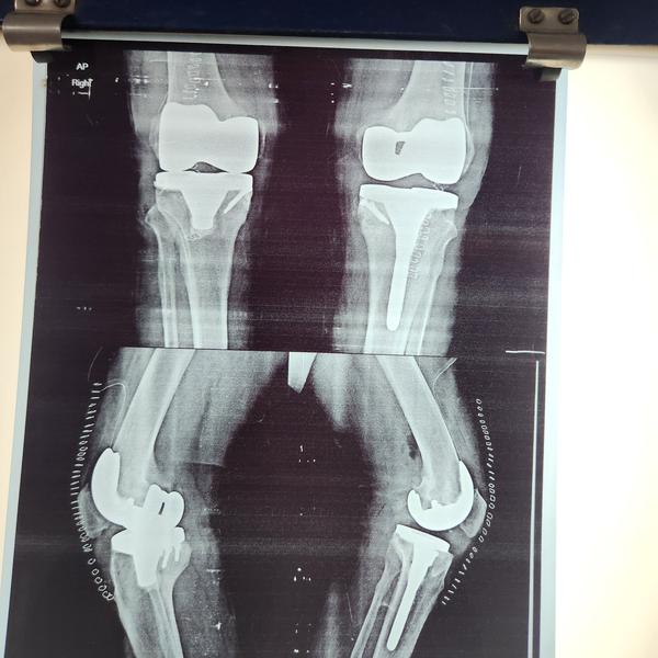 update image