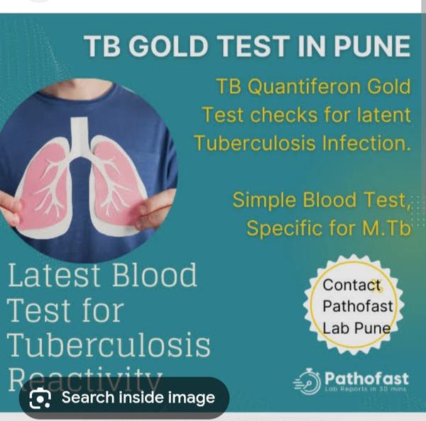 latent tb testing services cha