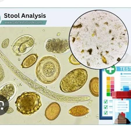 detecting urinary tract infect