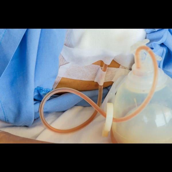 post operative and palliative