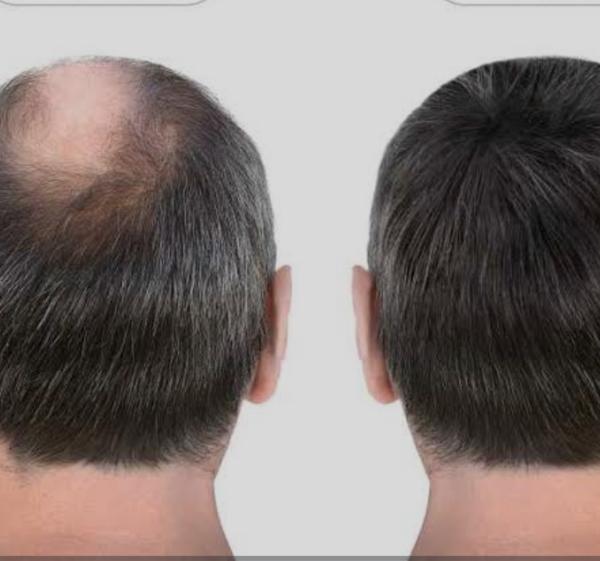 Singh Skin Cure is  professional hair wi