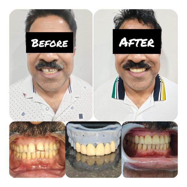 update image