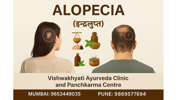 बाल झड़ना (Alopecia): क्या आपक