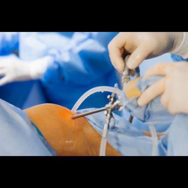 anterior cruciate ligament rec