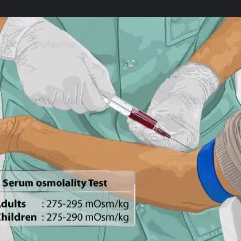 pseudo cholinesterase opc pois