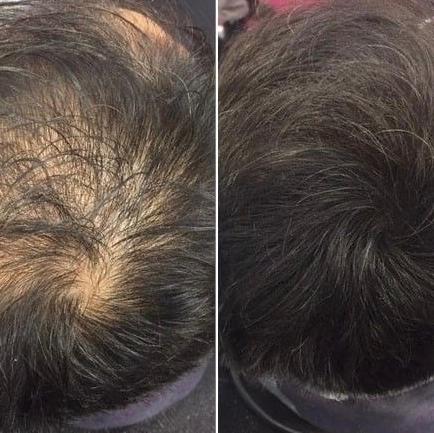 update image