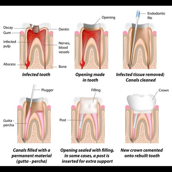 modern anesthesia dental clini