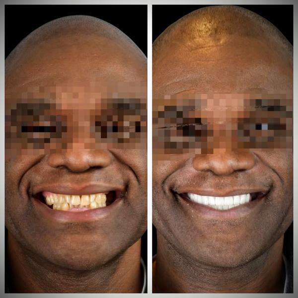 update image