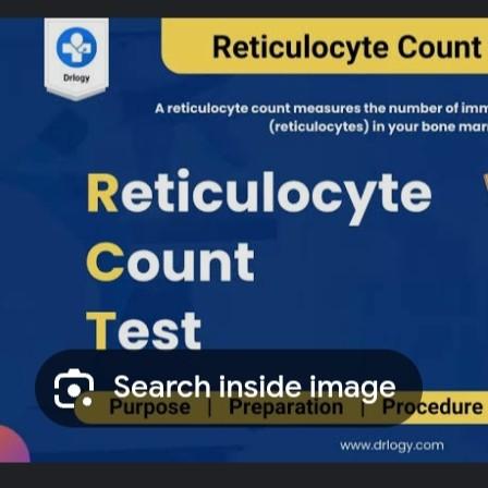 reticulocyte count blood test