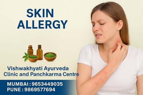 स्किन एलर्जी की जड़ से इलाज चा
