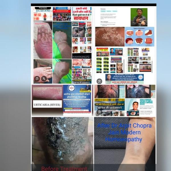 update image