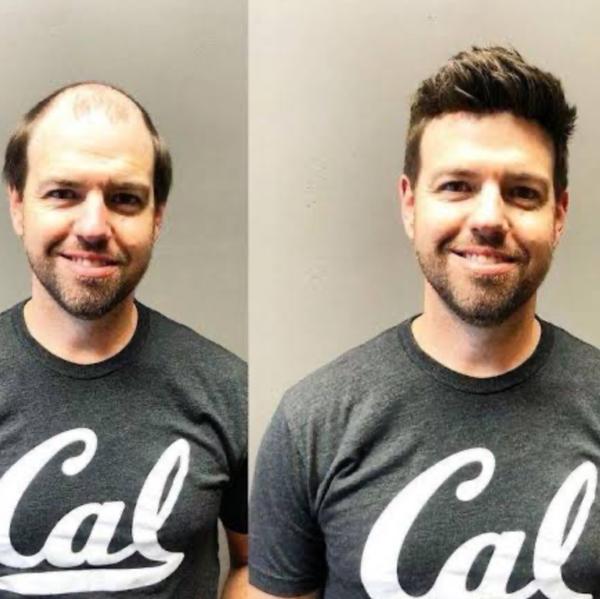 Singh Skin & Hair Fixing centre Sector 4