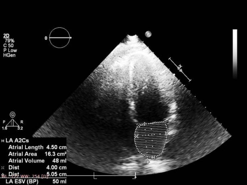 symptoms and complications of