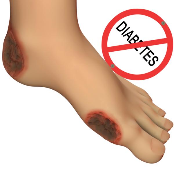 A small wound in a diabetic pa