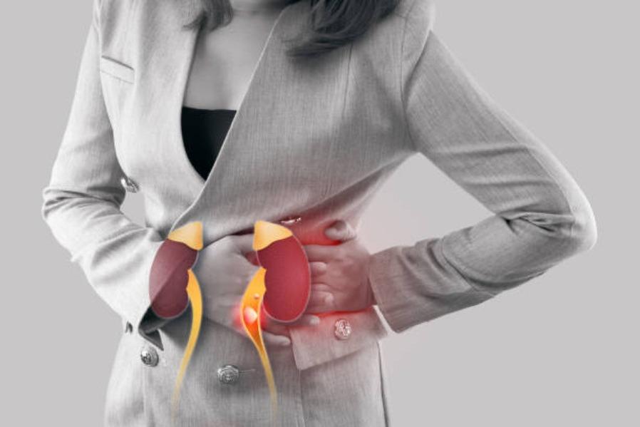 comprehensive kidney stone eva