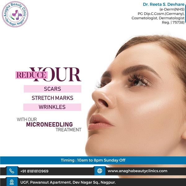 Microneedlig is a minimally invasive pro