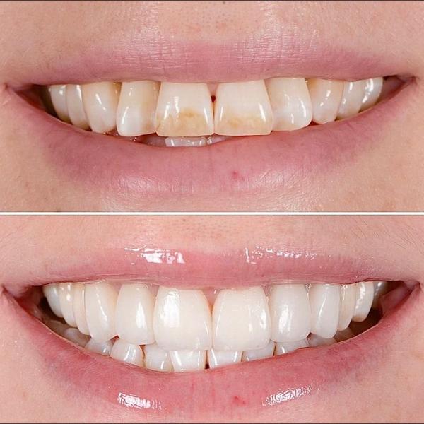 Best Cosmetic Dentist in Mansa