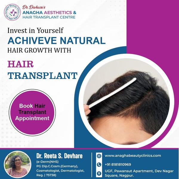 **Hair Transplant ransplant** A Hair Tra