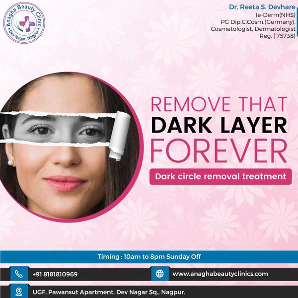 * Dark Circle Removal Treatment🥺* Dark 