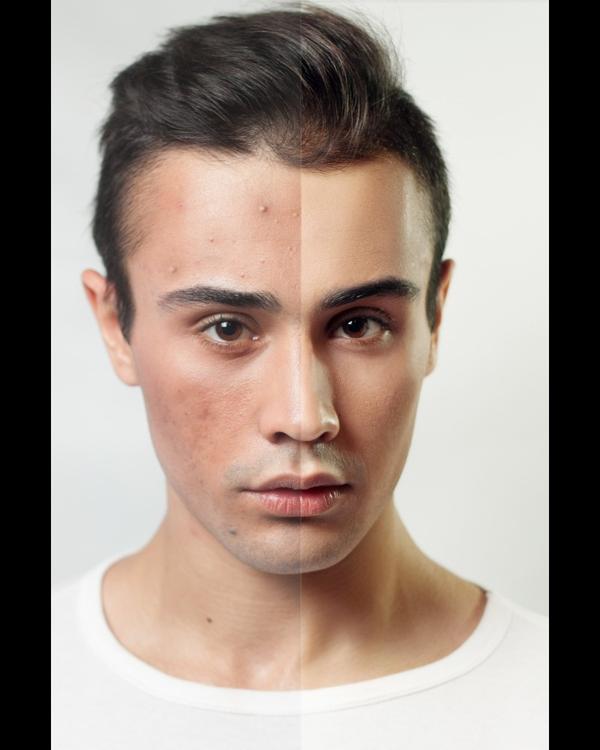 Men too face issues like tanni