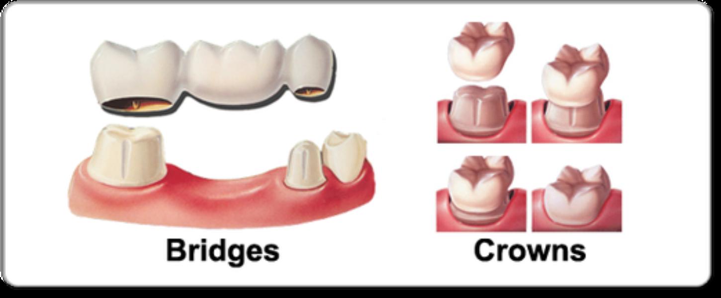 update image