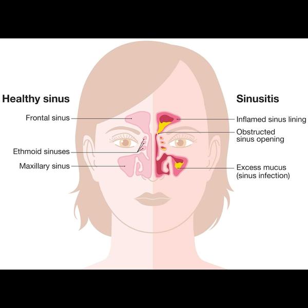dehradun nasal obstruction tre
