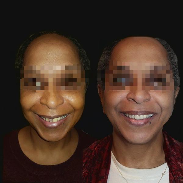 update image