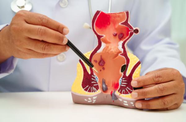 modern piles treatment santacr