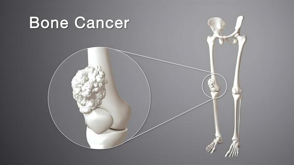 update image