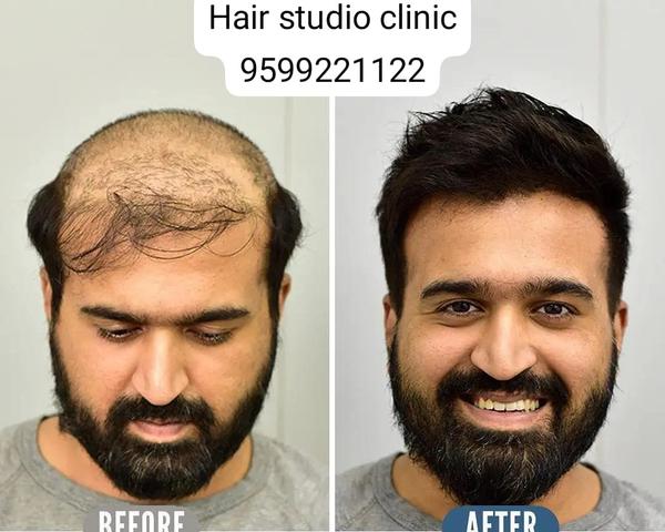 hair bonding in rohini