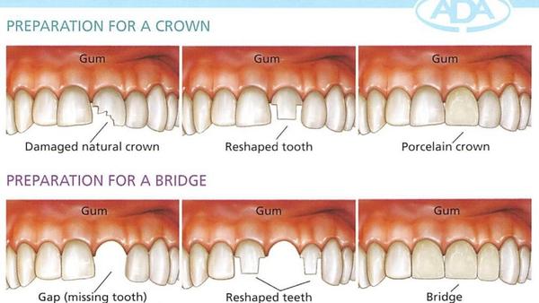 dental care experts mansarovar