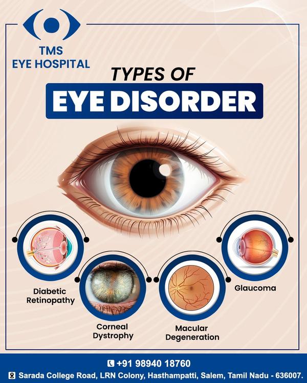 glaucoma and macular degenerat