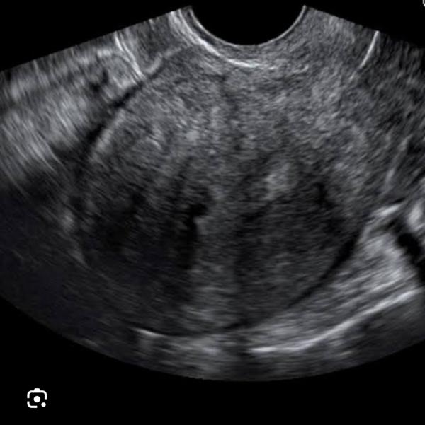 update image