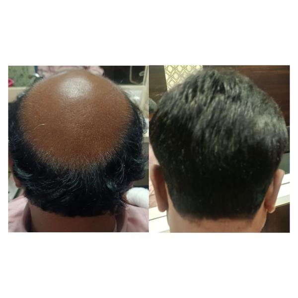 Best bonding centre in Nagpu reply your