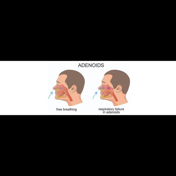 best adenoid surgeon jaipur