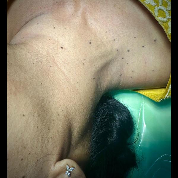 dermatologist photographic doc