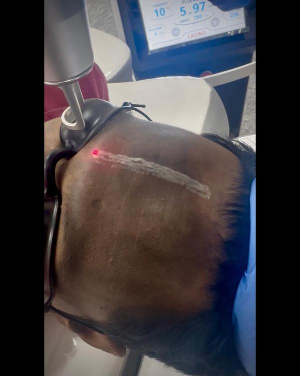 natural hair regrowth salem