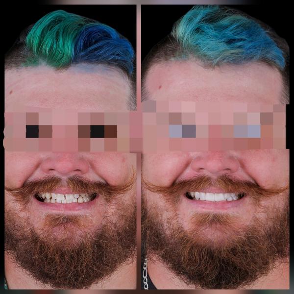 update image
