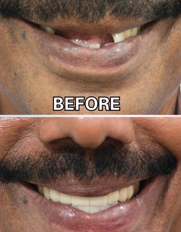 update image