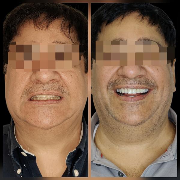 update image