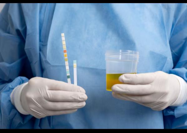 preventive health screening dw