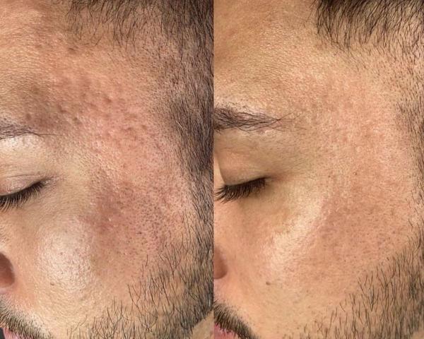 update image