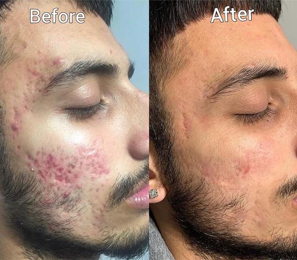 update image