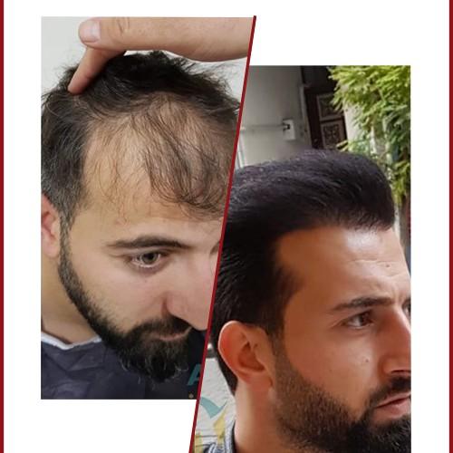 Our hair patch is the most eff