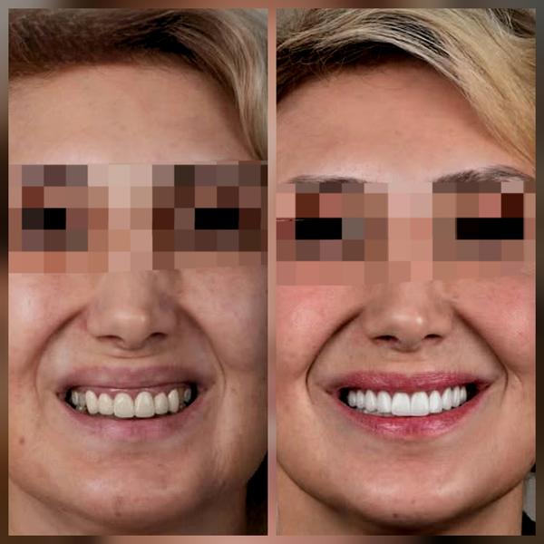 update image